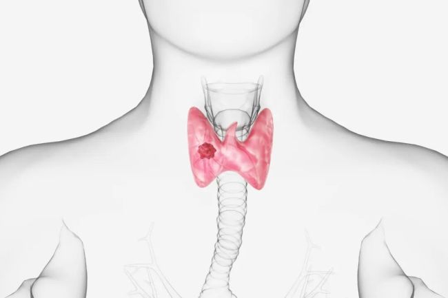 ��Щ�������������Σ�ֻ����ʹ��˶��ѣ���ƭǮ