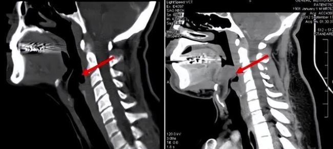 ���ڸ߷���ɤ���ۣ�����һ�����յļ�֢